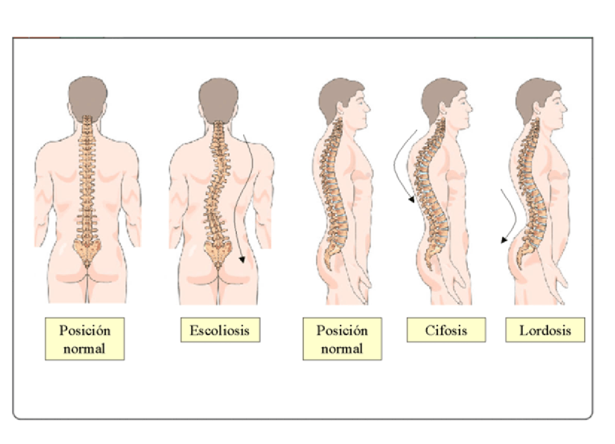 Curvaturas normotípicas de la columna vertebral./ Adaptado de