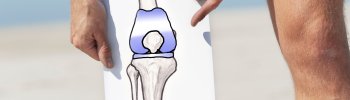 Rehabilitación postoperatoria tras una prótesis de rodilla