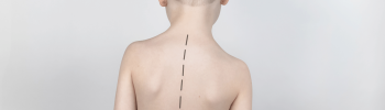 Escoliosis en niños y adolescentes: cómo detectarla y qué ejercicios pueden ayudar