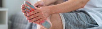 Fascitis Plantar: Qué es, Síntomas, Causas y Tratamiento