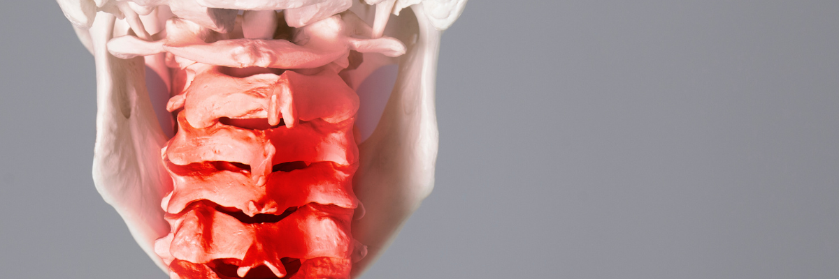 Tratamiento de la artrosis cervical con fisioterapia manual