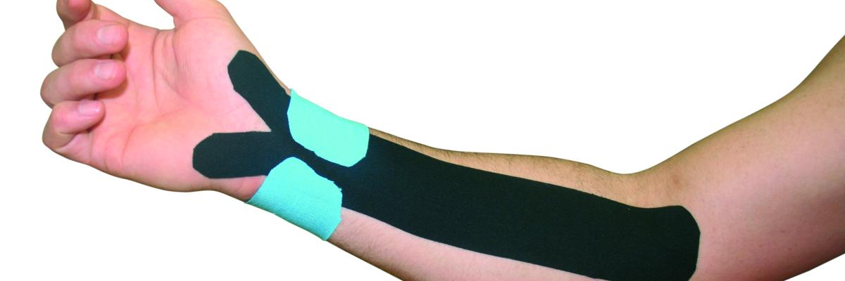 Efectividad de Kinesiotaping en el síndrome del túnel radial