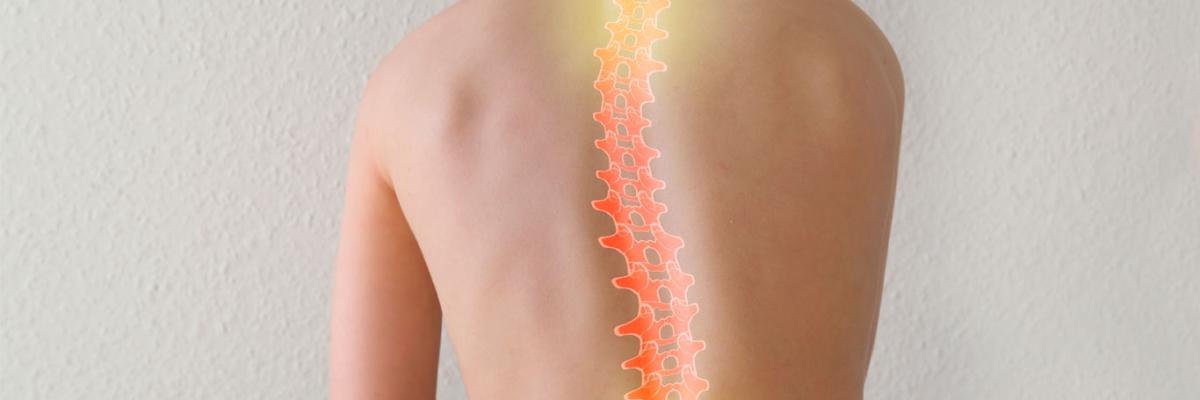 Fisioterapia para la escoliosis en adolescentes: ejercicios para corregir y fortalecer la columna