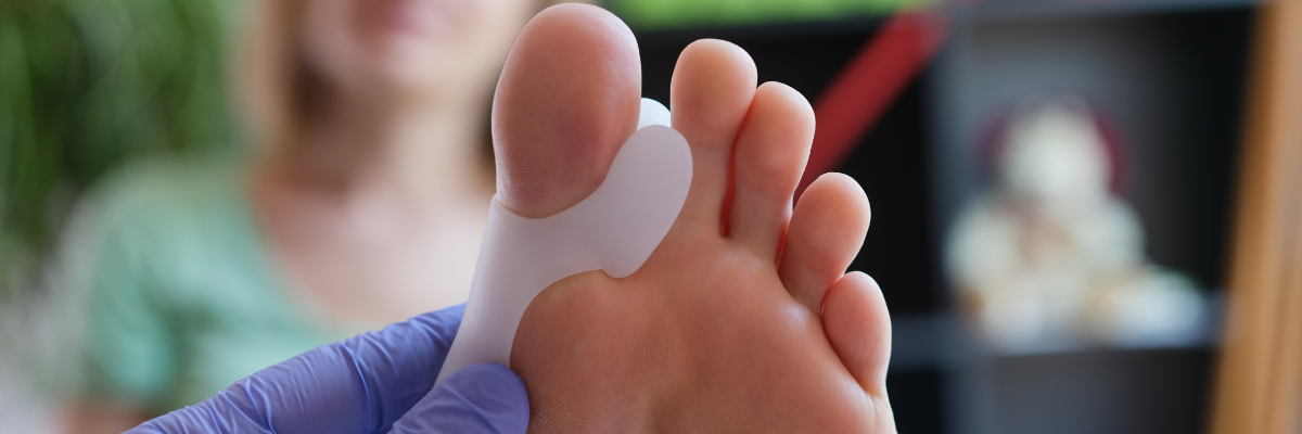 ¿Cuántos tipos de hallux valgus hay?