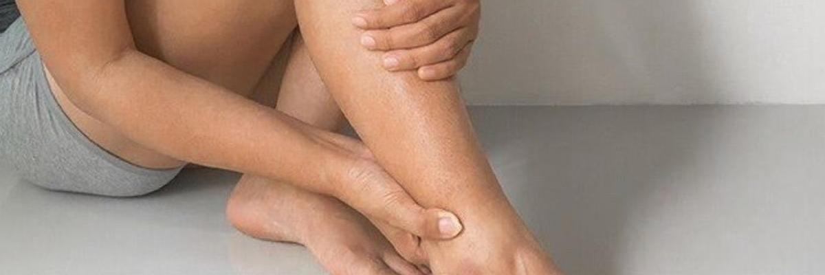 Problemas de circulación: abordaje de varices y sensación de piernas pesadas