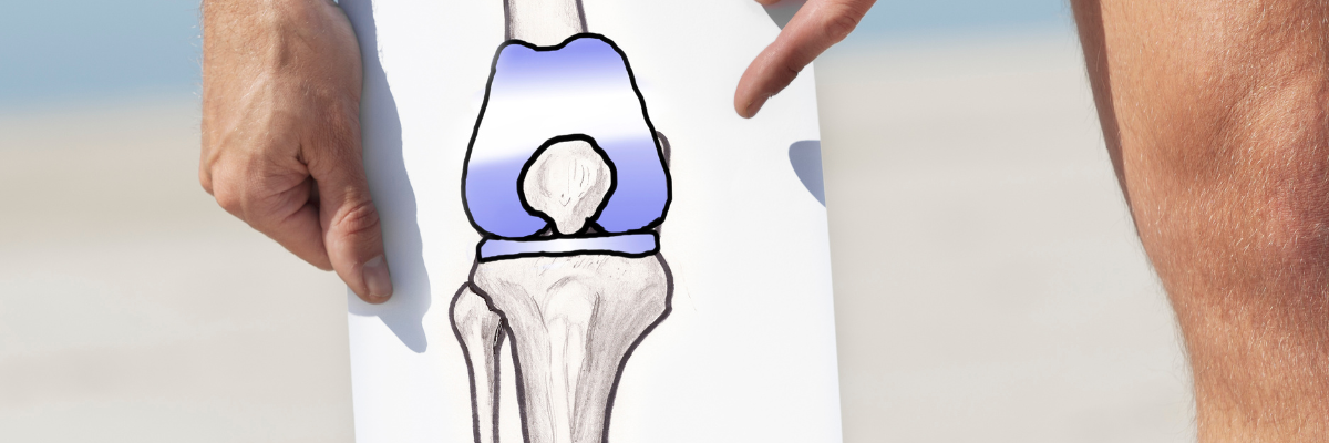 Terapias manuales para mejorar la movilidad en la artrosis de rodilla
