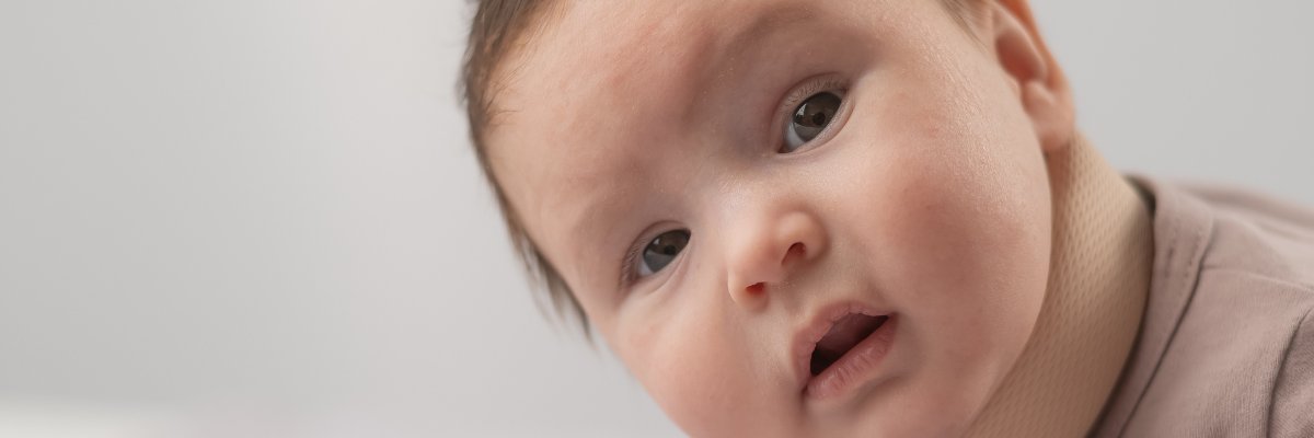 Fisioterapia para Bebés con Tortícolis: Ejercicios y Estiramientos para Mejorar la Movilidad del Cuello