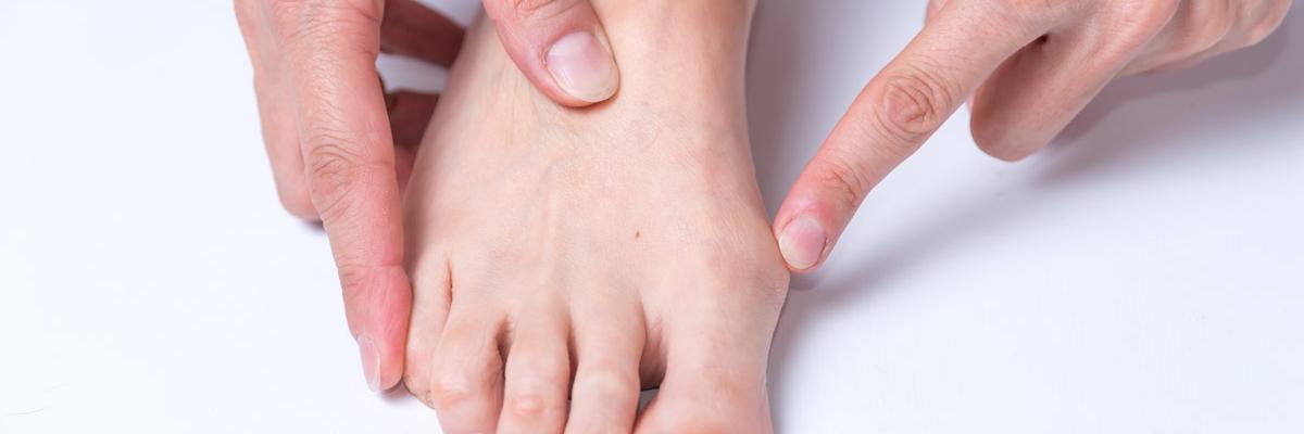 Fisioterapia preventiva en deformidades en juanetes (hallux valgus)