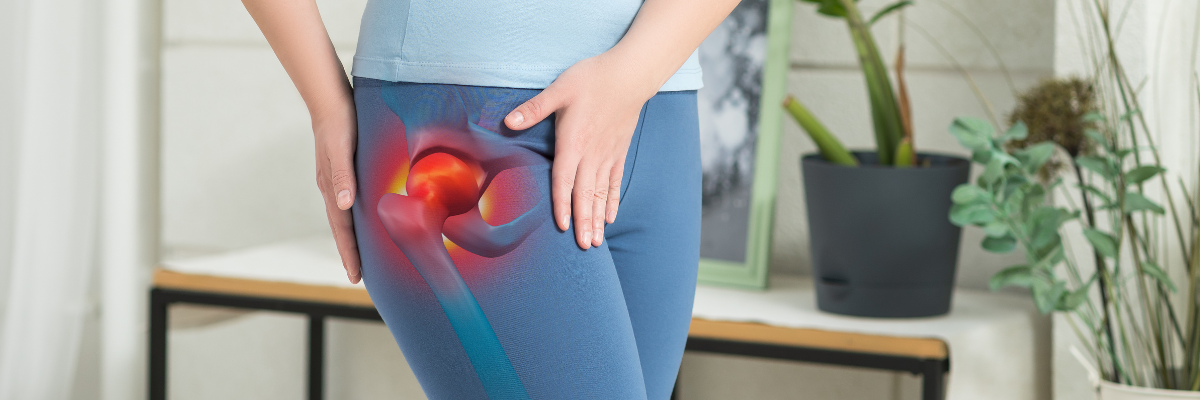 Prevención de la artrosis de cadera mediante fisioterapia y ejercicio