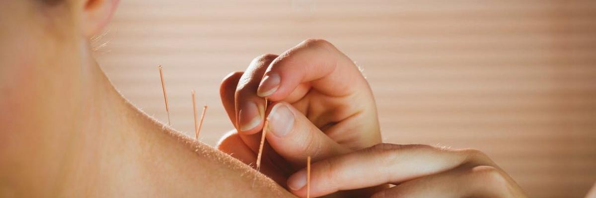 Síndrome del dolor miofascial