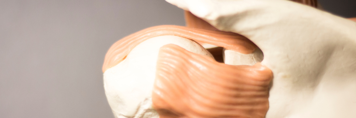 Cómo evitar recaídas tras una tendinitis de hombro